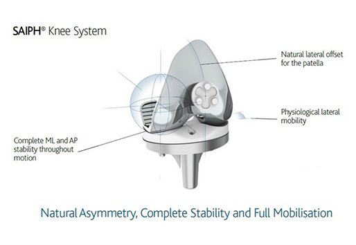 Knee System