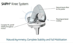 Knee System