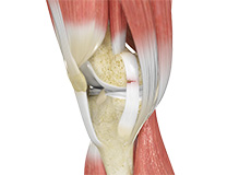 Ligament Injuries